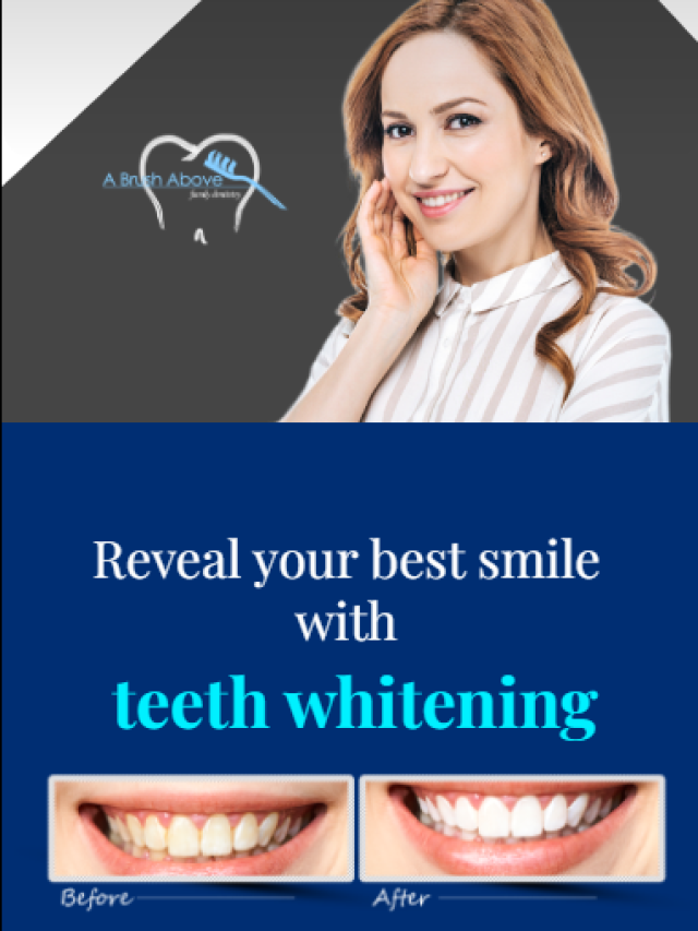 Reveal your best smile with teeth whitening