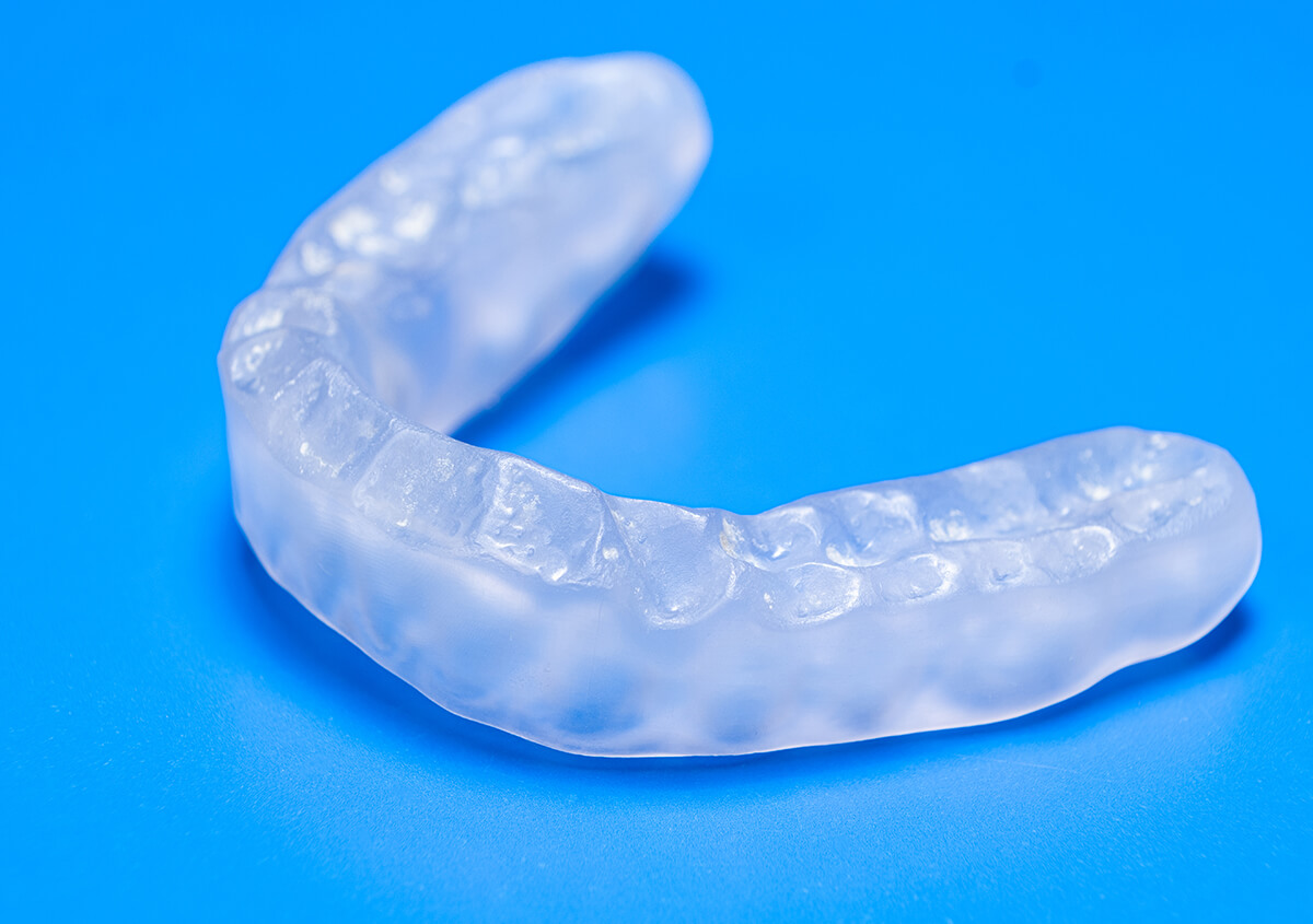 Types of Mouth Guards in Chicago IL Area